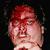 Marc all bloody after the barfight with Randy Walker in October 2003.